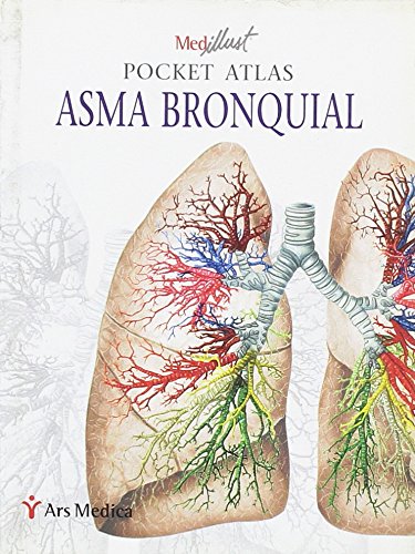 Pocket Atlas: Asma Bronquial