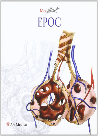 Pocket Atlas: EPOC
