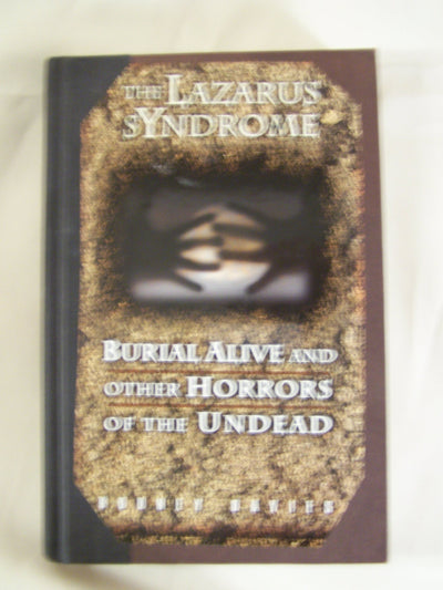 The Lazarus syndrome: Burial alive and other horrors of the undead