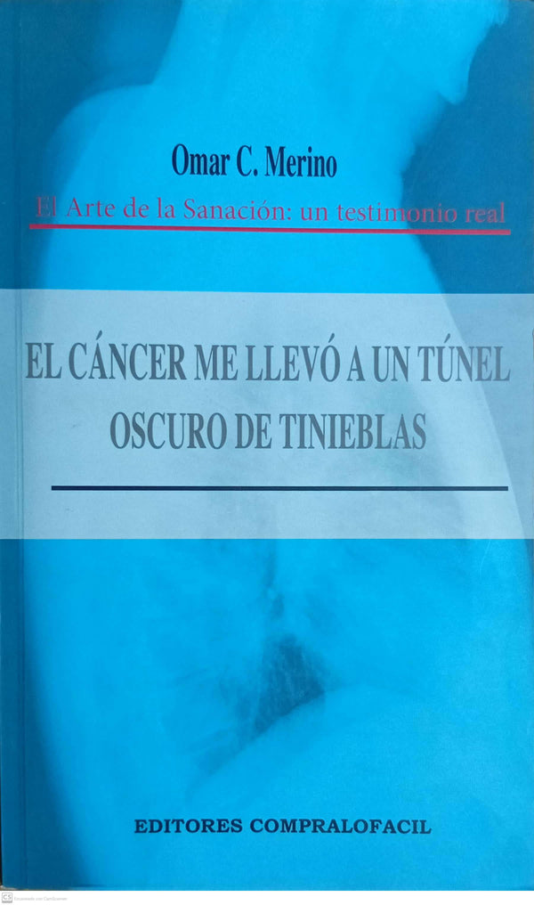 EL CANCER ME LLEVO A UN TUNEL OSCURO DE TENIEBLAS