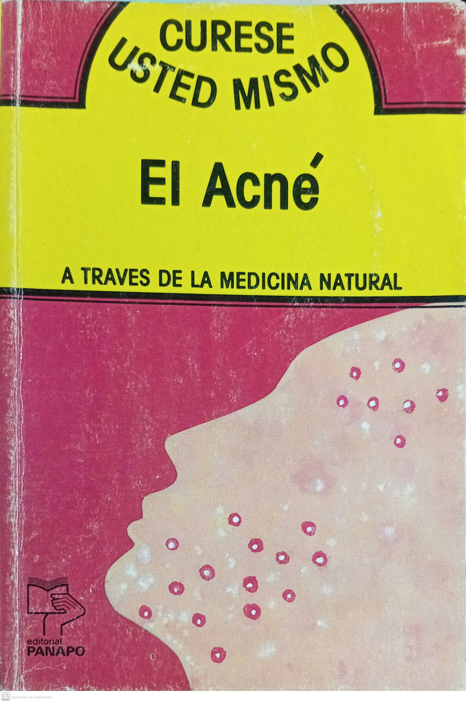 EL ACNE. A traves de la medicina natural