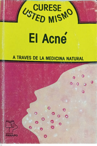 EL ACNE. A traves de la medicina natural