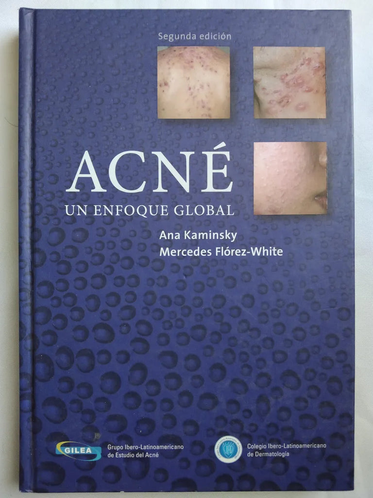 Acné. Un Enfoque Global
