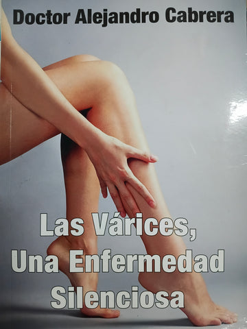 Las varices, una enfermedad silenciosa
