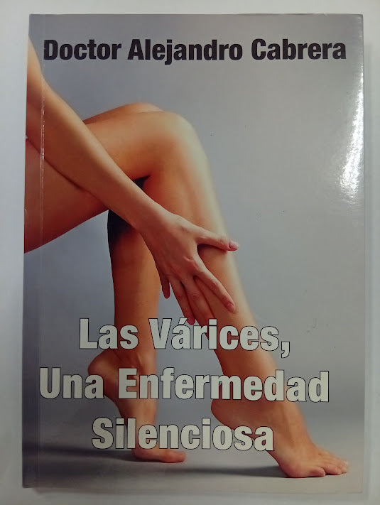 Las várices, una enfermedad silenciosa